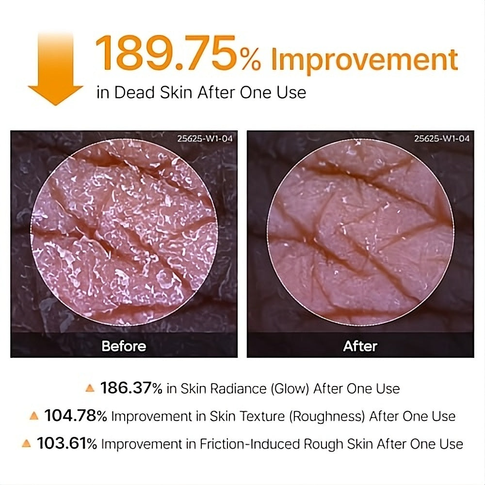 Dr. Melaxin Peel Shot Kojic Acid Turmeric Spray