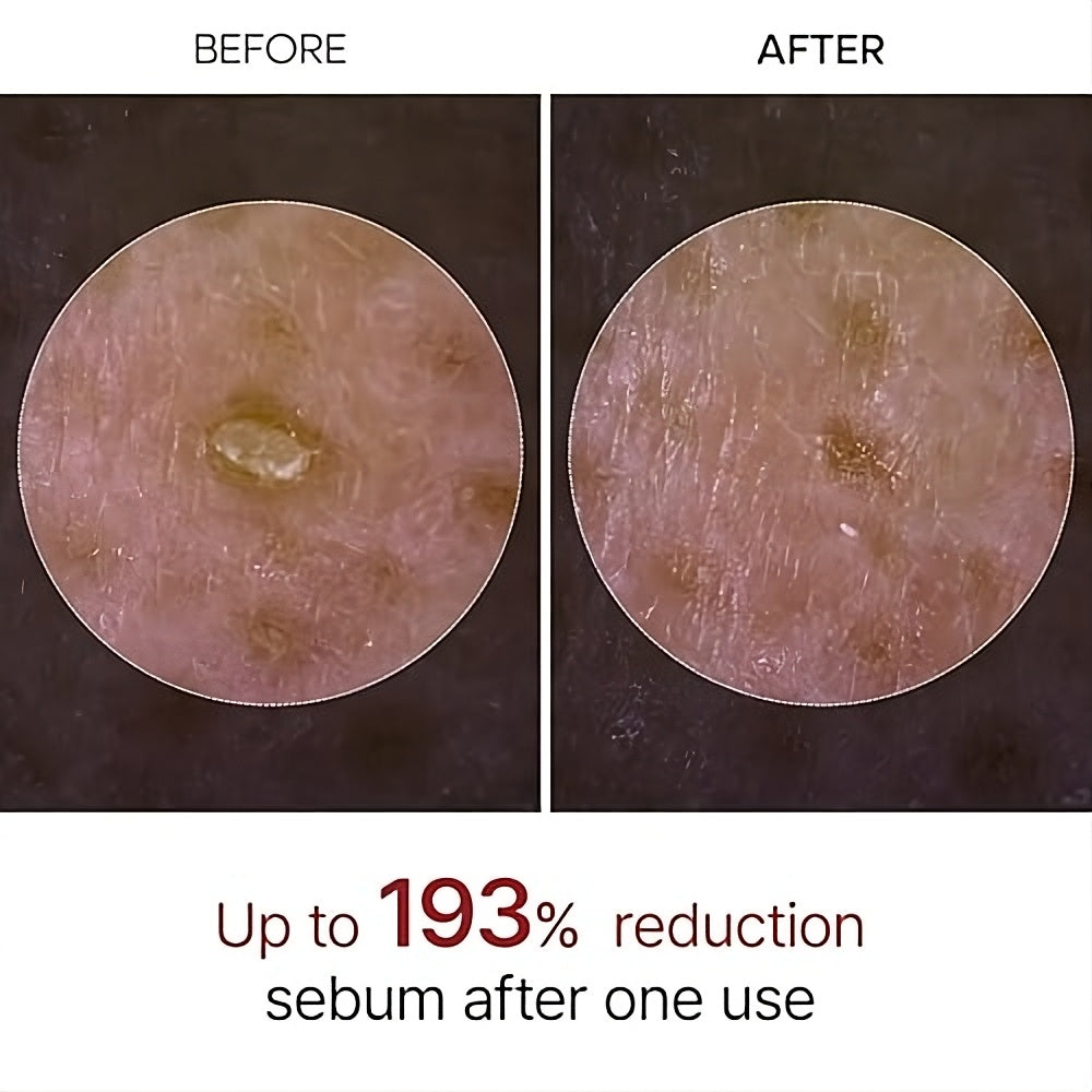 Dr. Melaxin Peel Shot Rice Exfoliating Serum Blackhead Removal Hydrating Korean Skin Care